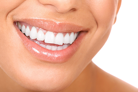 Blanqueamiento-2015-Dra-Emma-Periodoncia-Mexicali 